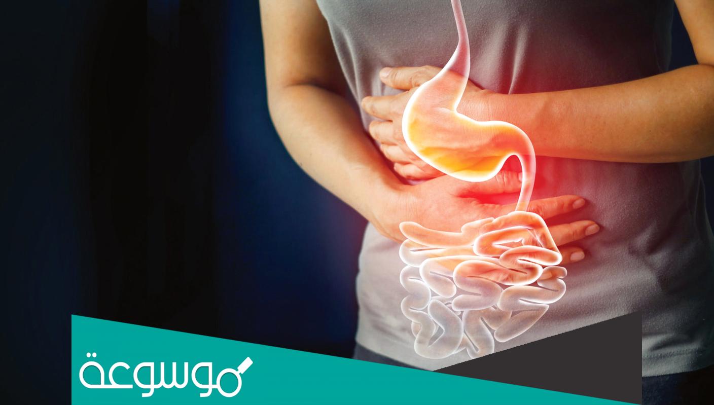 العلاقة بين الإصابة بالبواسير و الضغط النفسي