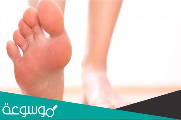 العلاقة بين السمنة والاصابة بالنقرس