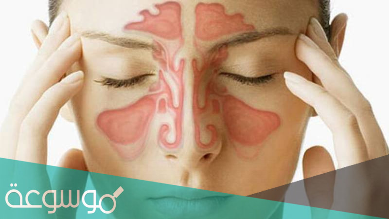المشاكل الشائعة للجيوب الانفية