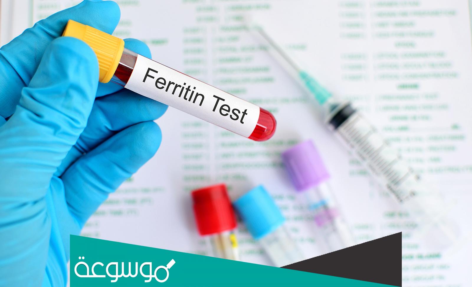 ما هو تحليل فيريتين وماذا يكشف نقصه او زيادته