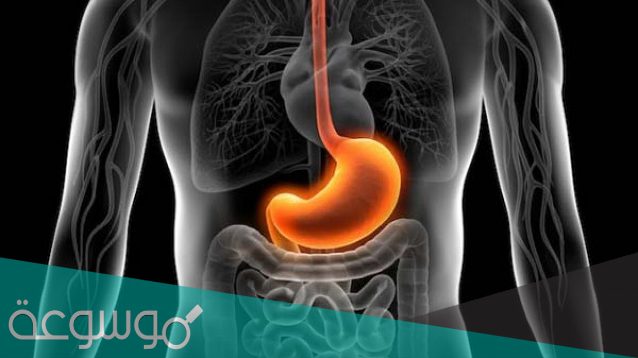 تقنيه ستريتا لعلاج ارتجاع المريء