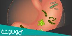 نسبة جرثومة المعدة 2022