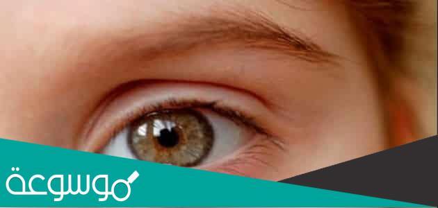 دمل العين أو شحاذ العين