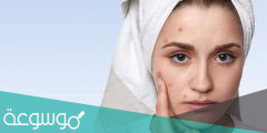سبب ظهور حبوب في الوجه ايام التبويض وعلاجه مجرب