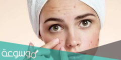 سبب ظهور حبوب في الوجه ايام التبويض وعلاجه مجرب