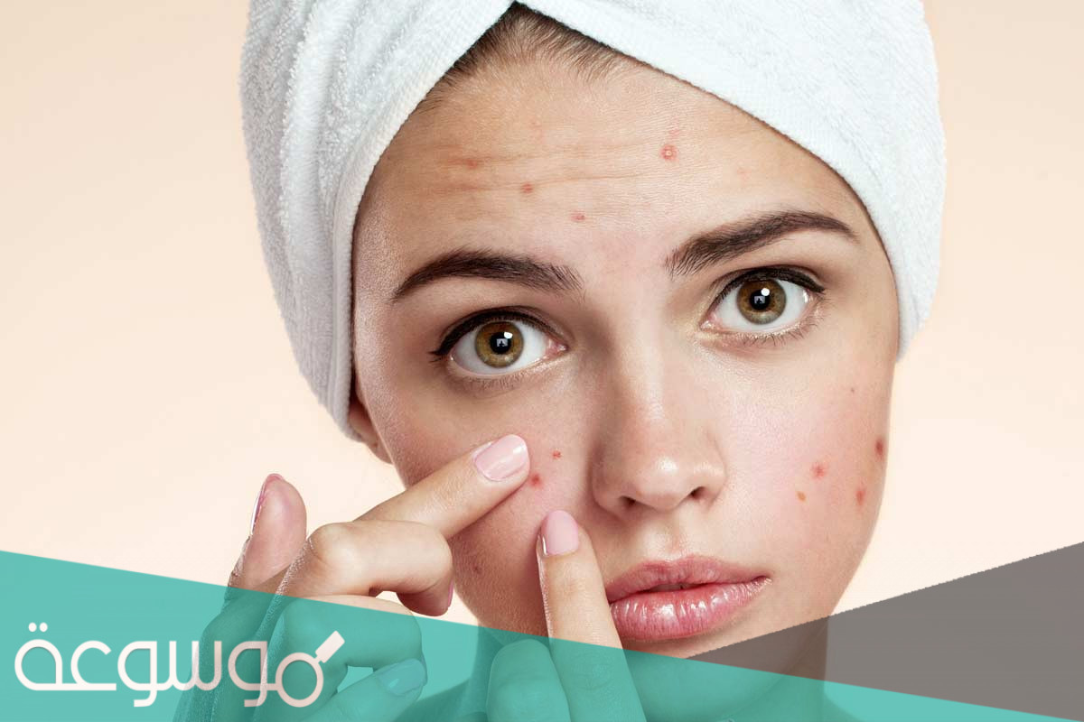 سبب ظهور حبوب في الوجه ايام التبويض وعلاجه مجرب