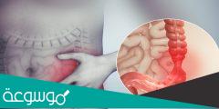كيف أعرف فيني قولون عصبي ؟.. وهل الجوع يثيره