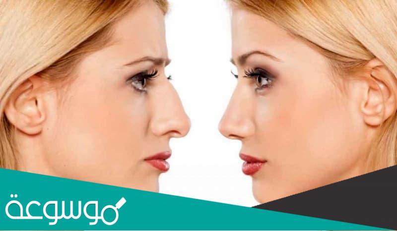 كيفية تصغير الأنف بتقنية الفيلر