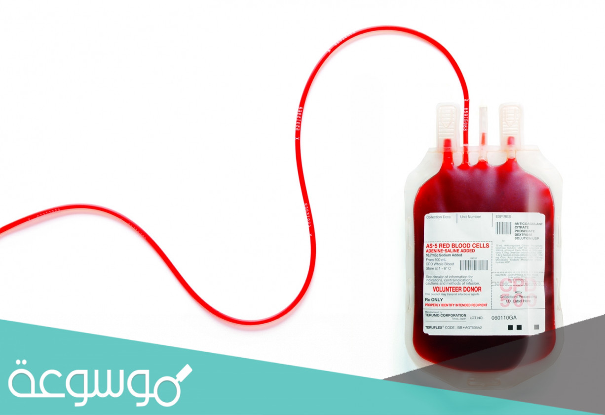 لماذا لون الدم في الشريان الرئوي قاتم