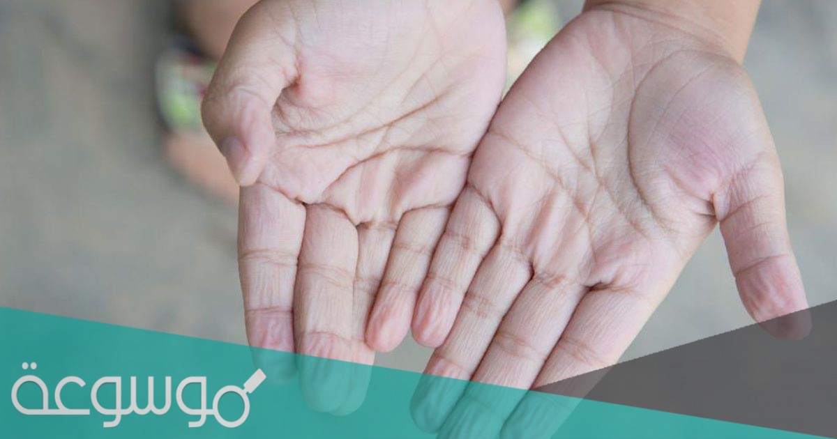 لماذا يتجعد جلد الانسان عندما يمكث مده طويله في الماء