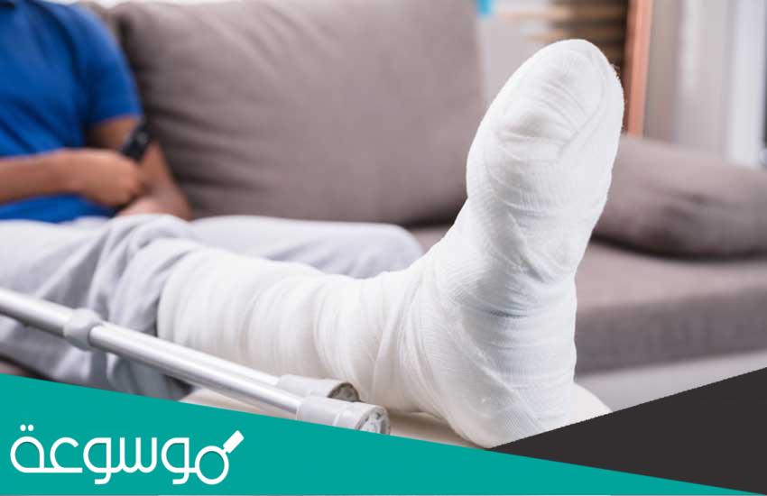 ما ذا يعني ” كسر مضاعف ” ؟.. وما أنواع الكسور في العظام