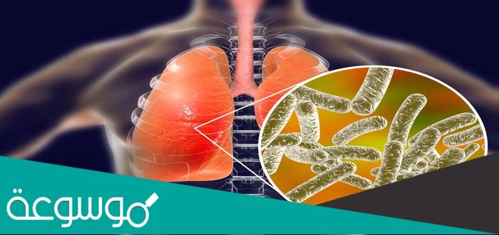 ما هو مرض الليجيونيرز وأعراضه وعلاجه