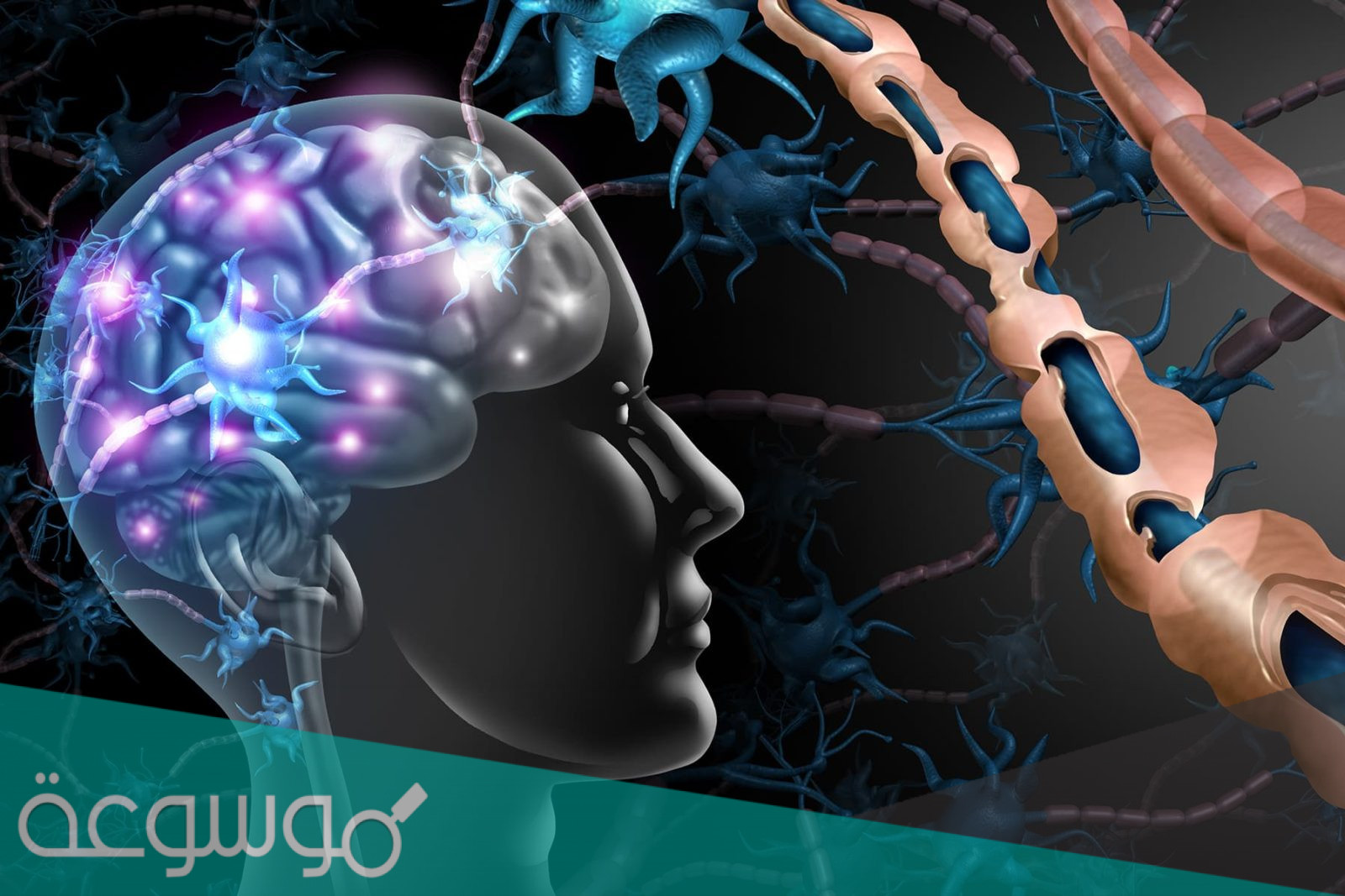 ما هو مرض ام اس في المخ وما هي اعراضه