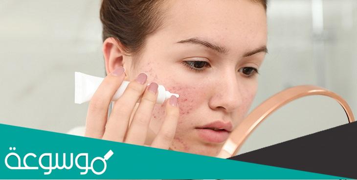 مستحضرات امريكية لعلاج حب الشباب وترطيب البشرة الثلاثينية