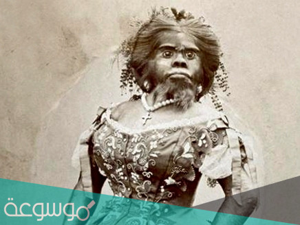 مسوخ السيرك في القرن الماضي الذين تم استغلالهم