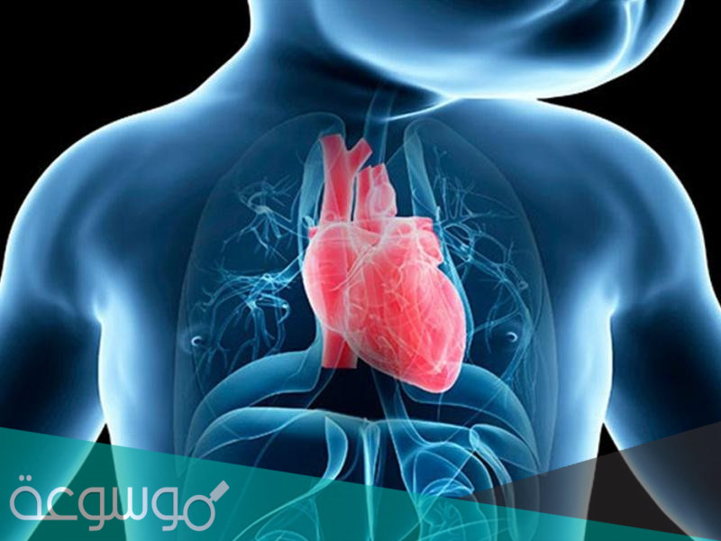 معلومات عن مرض رباعية فالو