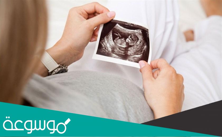 من يحدد نوع الجنين الرجل ام المراة