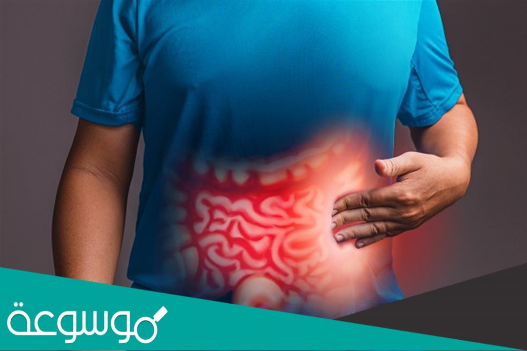 هل القولون العصبي يسبب الوسواس القهري