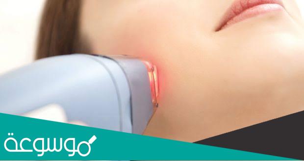 هل يختفي الشعر نهائيا بعد الليزر