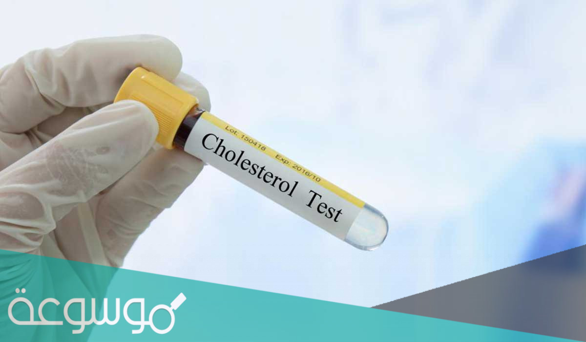 هل يمكن فحص الكولسترول في المنزل