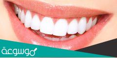 كيف يمكن التخلص من الاسنان الصفراء