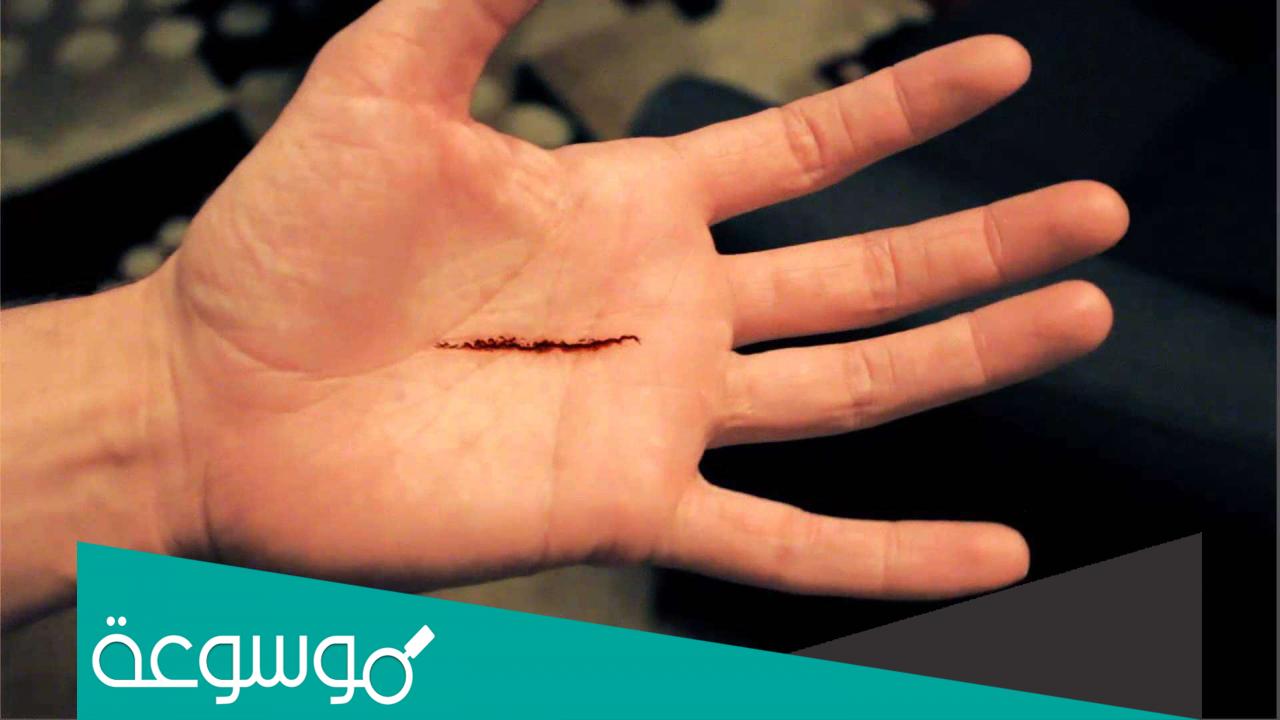 تفسير رؤية جرح اليد في المنام حسب تفسير ابن سيرين