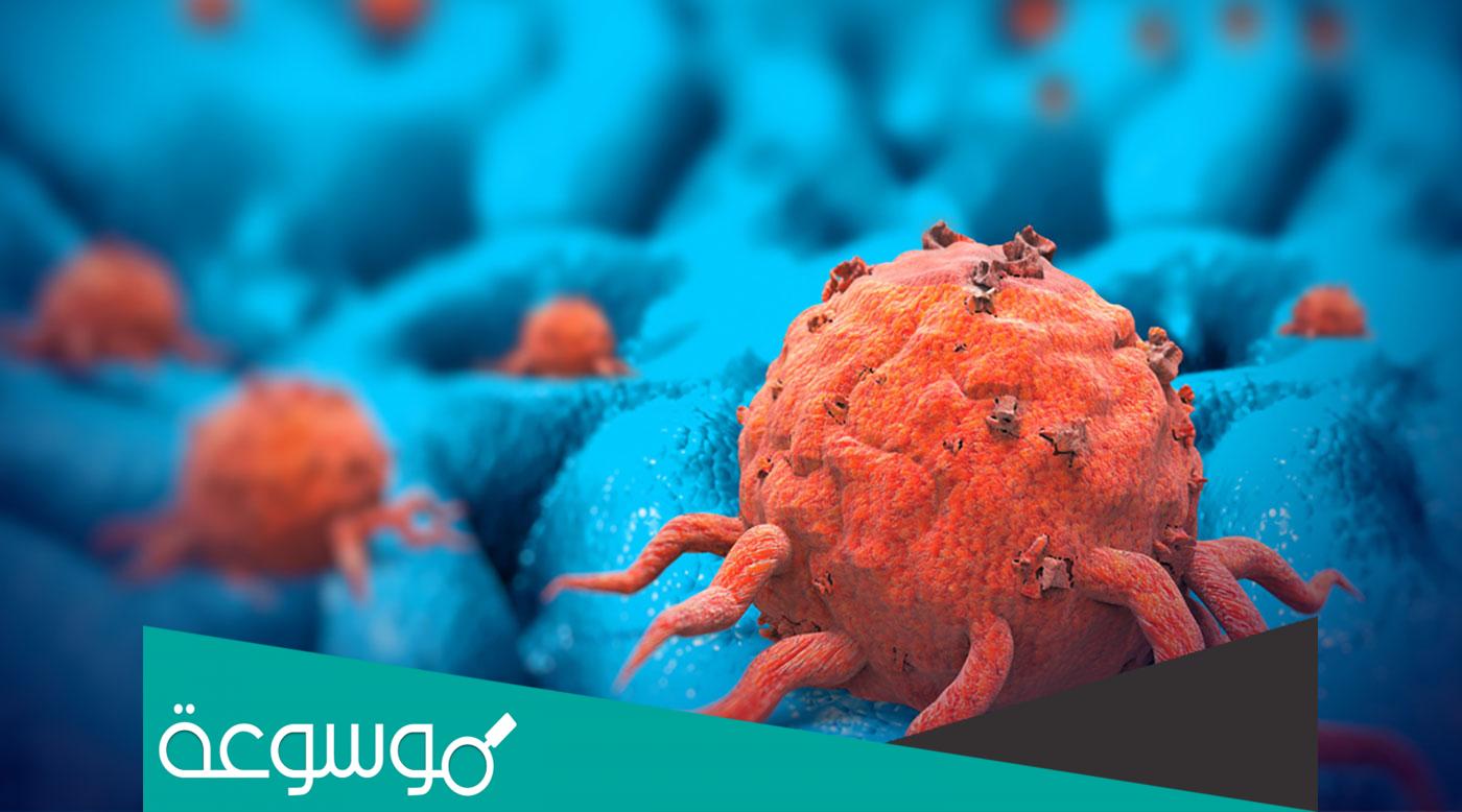 تفسير رؤية السرطان في المنام حسب تفسير ابن سيرين