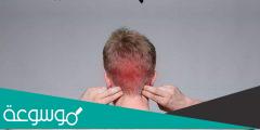 معلومات عن اسباب الصداع من الخلف