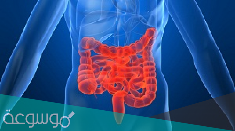 أسباب الإصابة بالتهاب القولون الإقفاري و أهم أعراضه