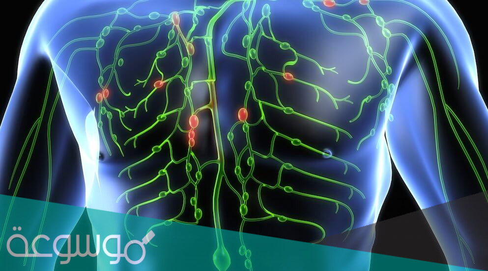 أسباب التهاب و تضخم الأوعية الليمفاوية