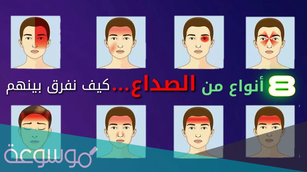 أماكن وجع الرأس وأسبابها