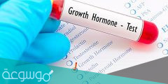 أنواع تحليل هرمون النمو بالتفصيل