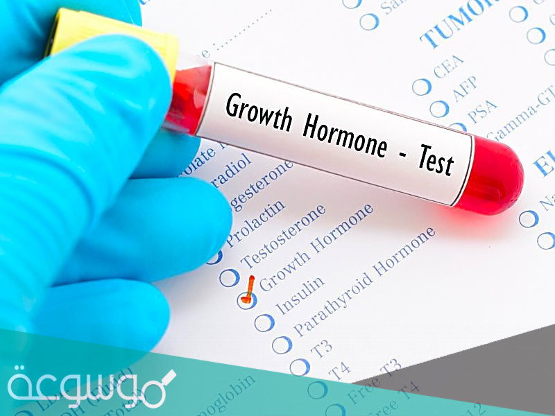 أنواع تحليل هرمون النمو بالتفصيل