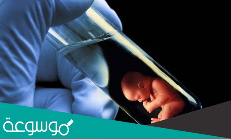 إمكانية إختيار نوع الجنين في الحقن المجهري