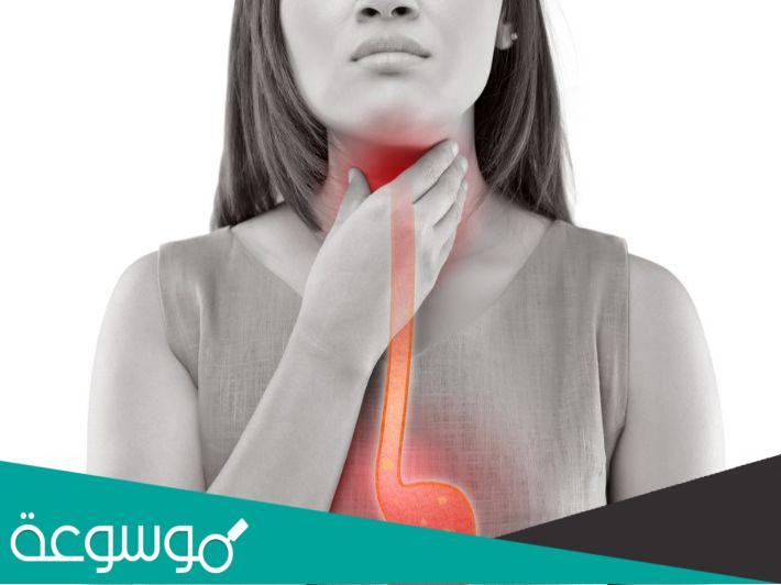 الاطعمة التى تفيد فى الارتجاع المريء