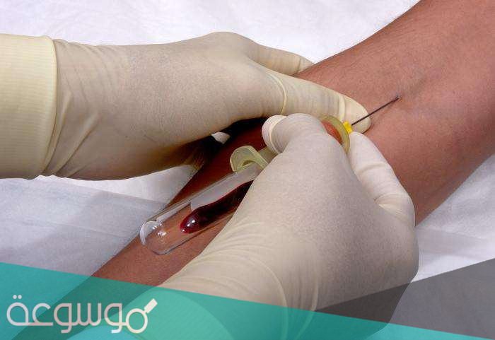 الفرق بين البلازما والصفائح الدموية