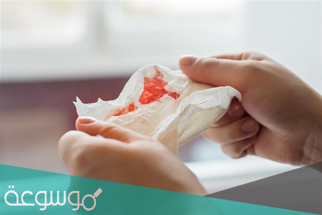 تشخيص خروج بلغم دم وعلاجه