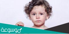 حساسية الاطفال من الادوية المختلفة