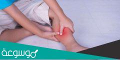 ماذا تعرف عن تشنجات الساق أثناء الليل وأسبابها