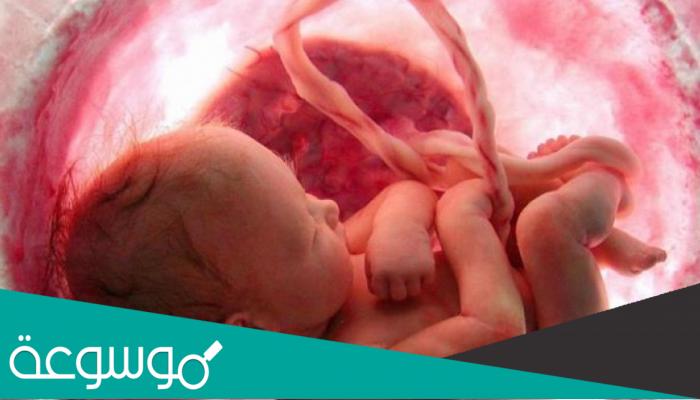 طرق علاج نقص الماء حول الجنين