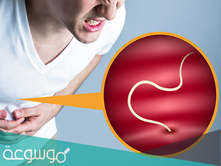 علاج الديدان بطرق طبيعية