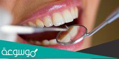 أسباب تآكل الأسنان