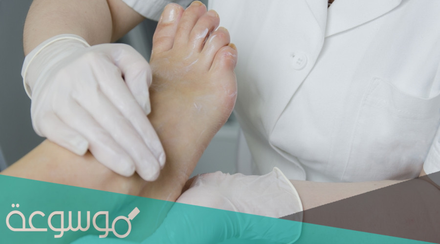 علاج قرح قدم مرض السكري