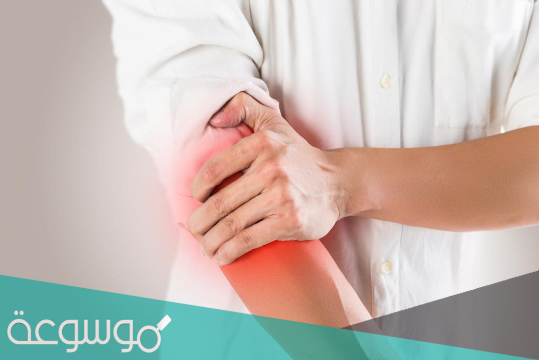 كسر كوليز من اكثر الكسور الشائعة