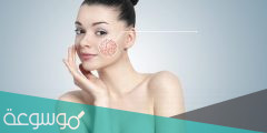 كيفية علاج حساسيه الوجه وجفافه في يوم واحد