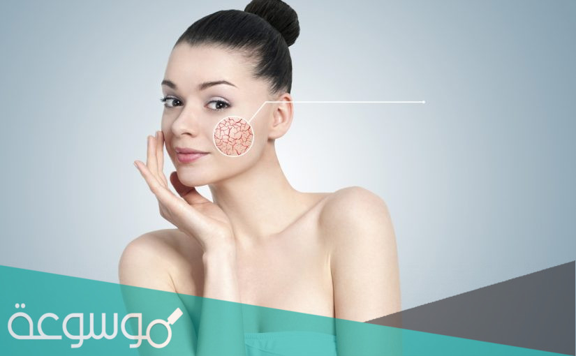 كيفية علاج حساسيه الوجه وجفافه في يوم واحد