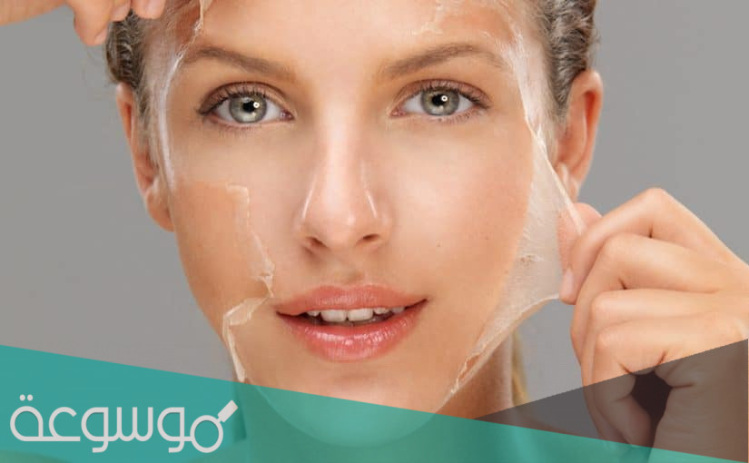 متى يتقشر الوجه بعد التقشير البارد