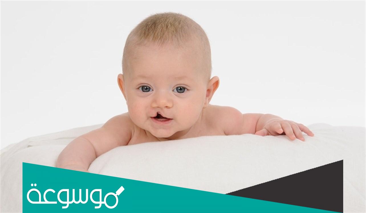 متى يتم اكتشاف الشفة الأرنبية متى تظهر بالسونار