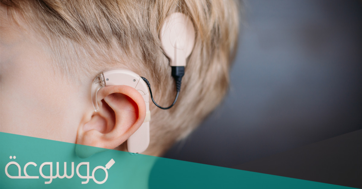 معلومات عامة عن عملية زراعة القوقعة