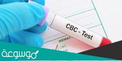 معلومات عن اختبار الدم الشامل
